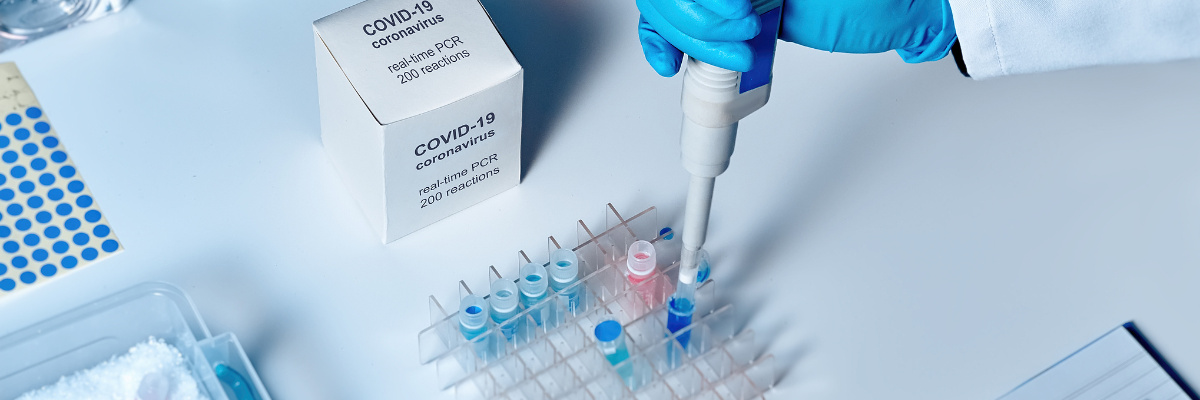 What are the functions of amino modification?