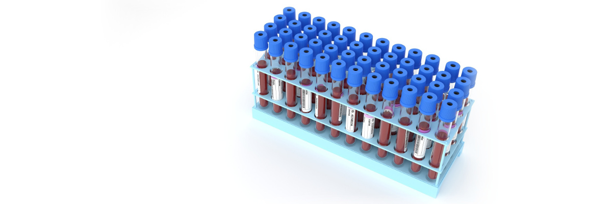 What are the functions of Locked Nucleic Acid (LNA) modification? 