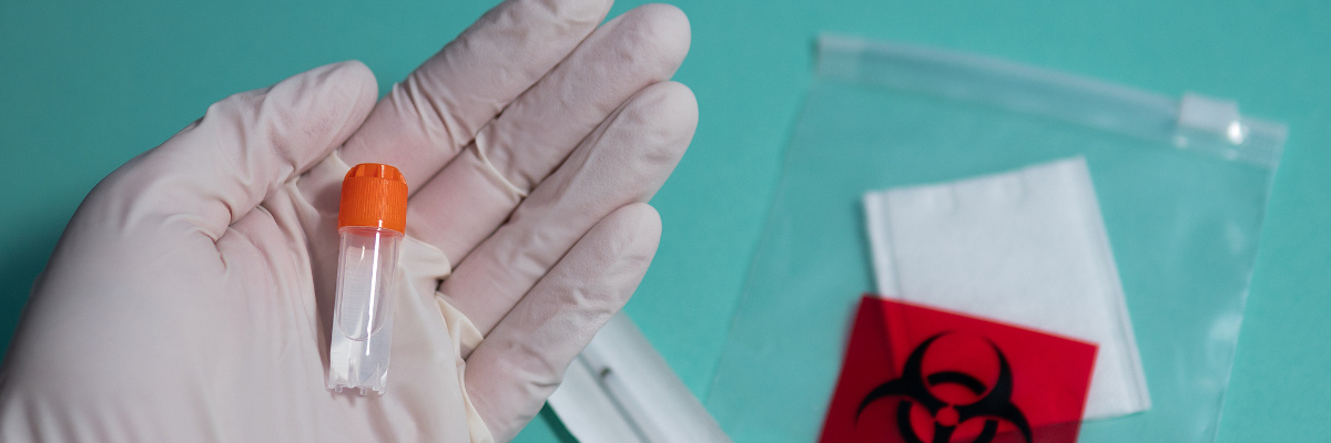 Tips for qPCR probe design 