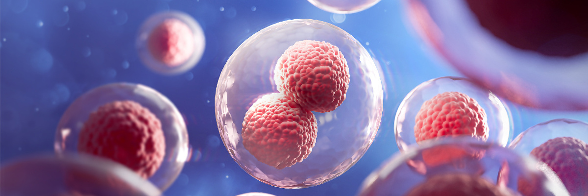 What are the characteristics of the E. coli expression system? 
