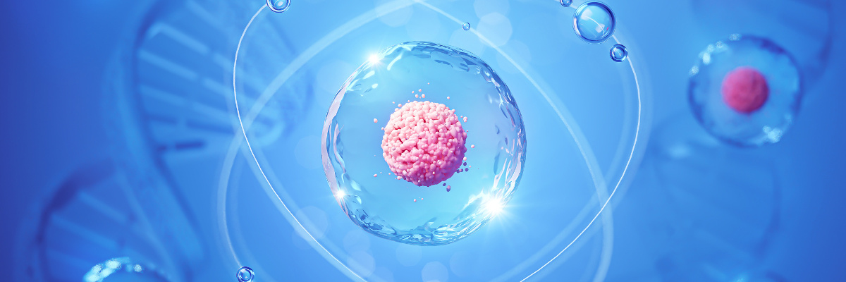 What insect cells are commonly used for protein expression?