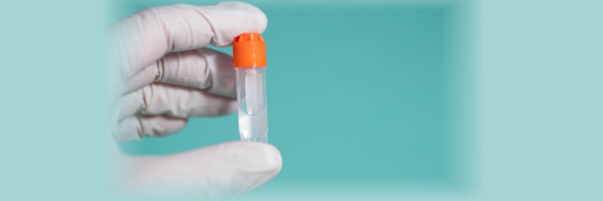 What are the common types of oligonucleotide base modifications? 