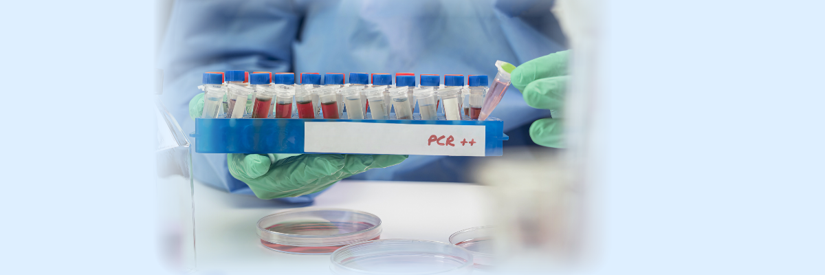 Tips for qPCR probe design 